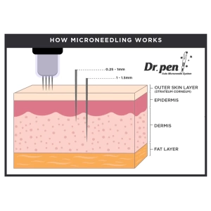 Zomorad.com photo DrPen How microneedling works v1 01 600x600