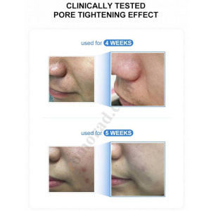 zomorad.com photo medicube Zero Pore Serum 2 0 07