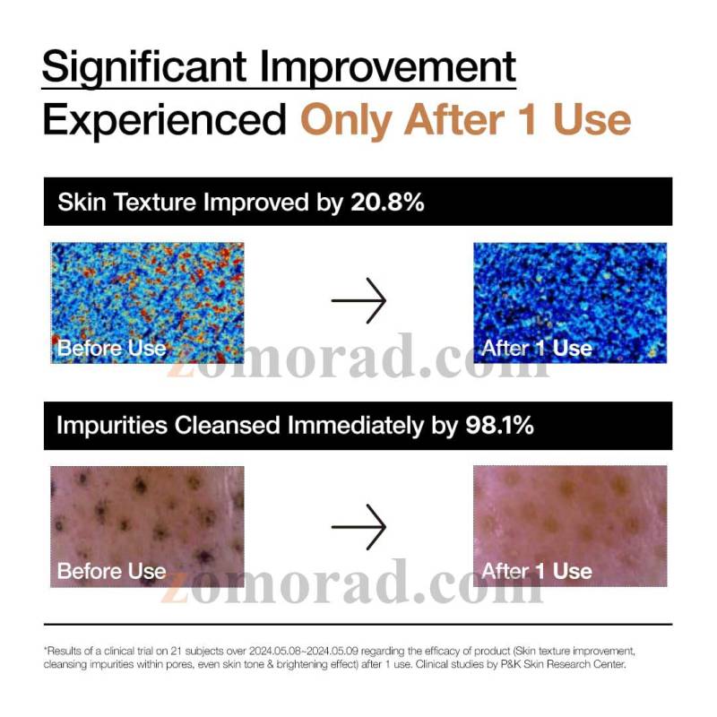 zomorad.com photo ANUA RICE ENZYME BRIGHTENING CLEANSING POWDER 05