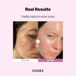 zomorad.com photo COSRX The Niacinamide 15 Serum 08