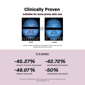 zomorad.com photo COSRX The Niacinamide 15 Serum 14