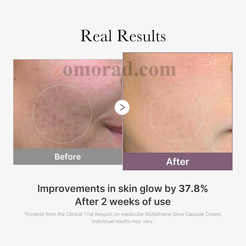 medicube AGE R Glutathione Glow Capsule Cream 07