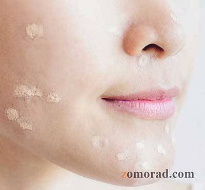 zomorad.com-post-Why does my face break out after applying foundation-چرا صورتم بعد از کرم پودر جوش می‌زند-01