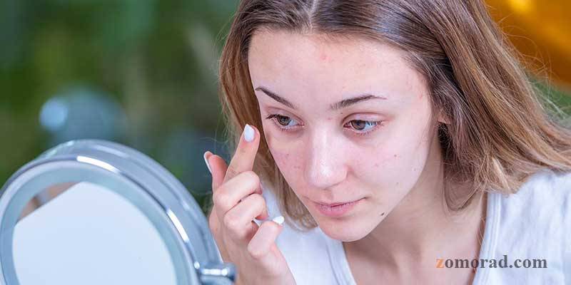 zomorad.com-post-Why does my face break out after applying foundation-چرا صورتم بعد از کرم پودر جوش می‌زند-main