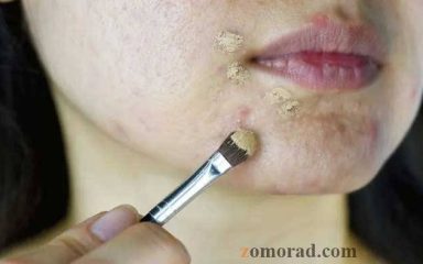 zomorad.com post بهترین کرم پودر برای پوست چرب و جوش دار 01