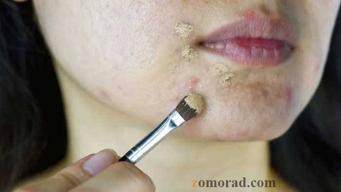 zomorad.com post بهترین کرم پودر برای پوست چرب و جوش دار 01